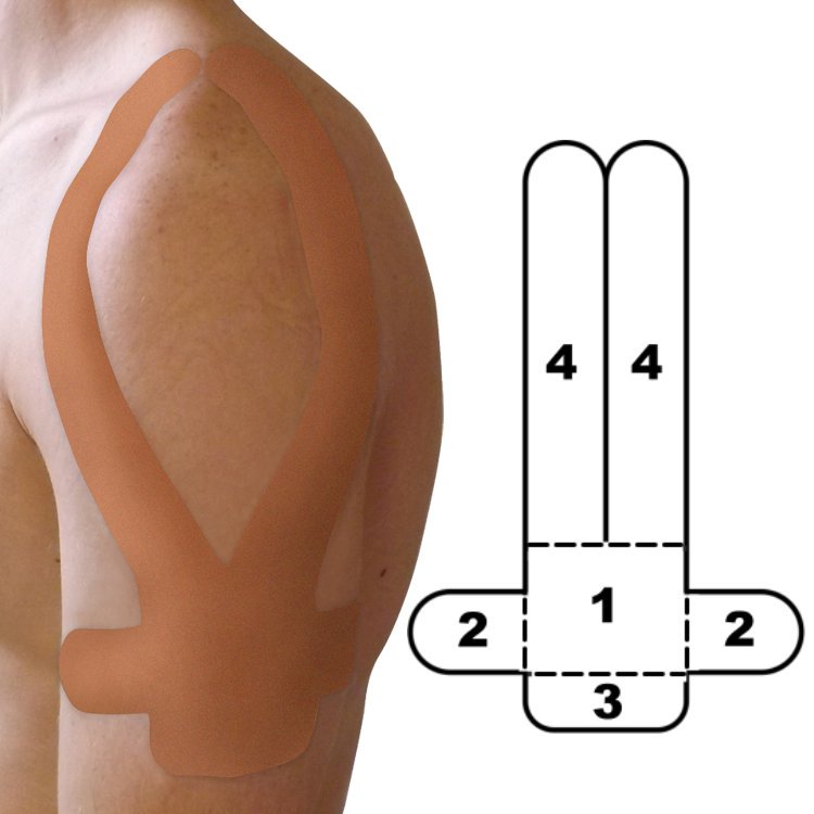 Kindmax Precut Shoulder Tape - Beige