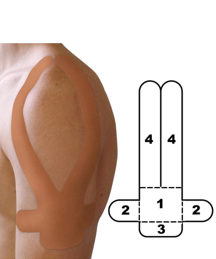 Kindmax Precut Shoulder Tape - Beige
