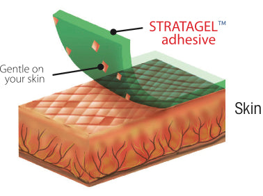 SpiderTech Gentle Stratagel Adhesive