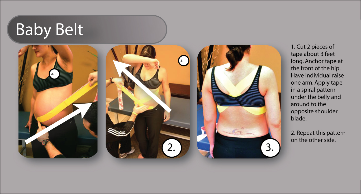 Тейпы на живот для похудения результаты до и после фото