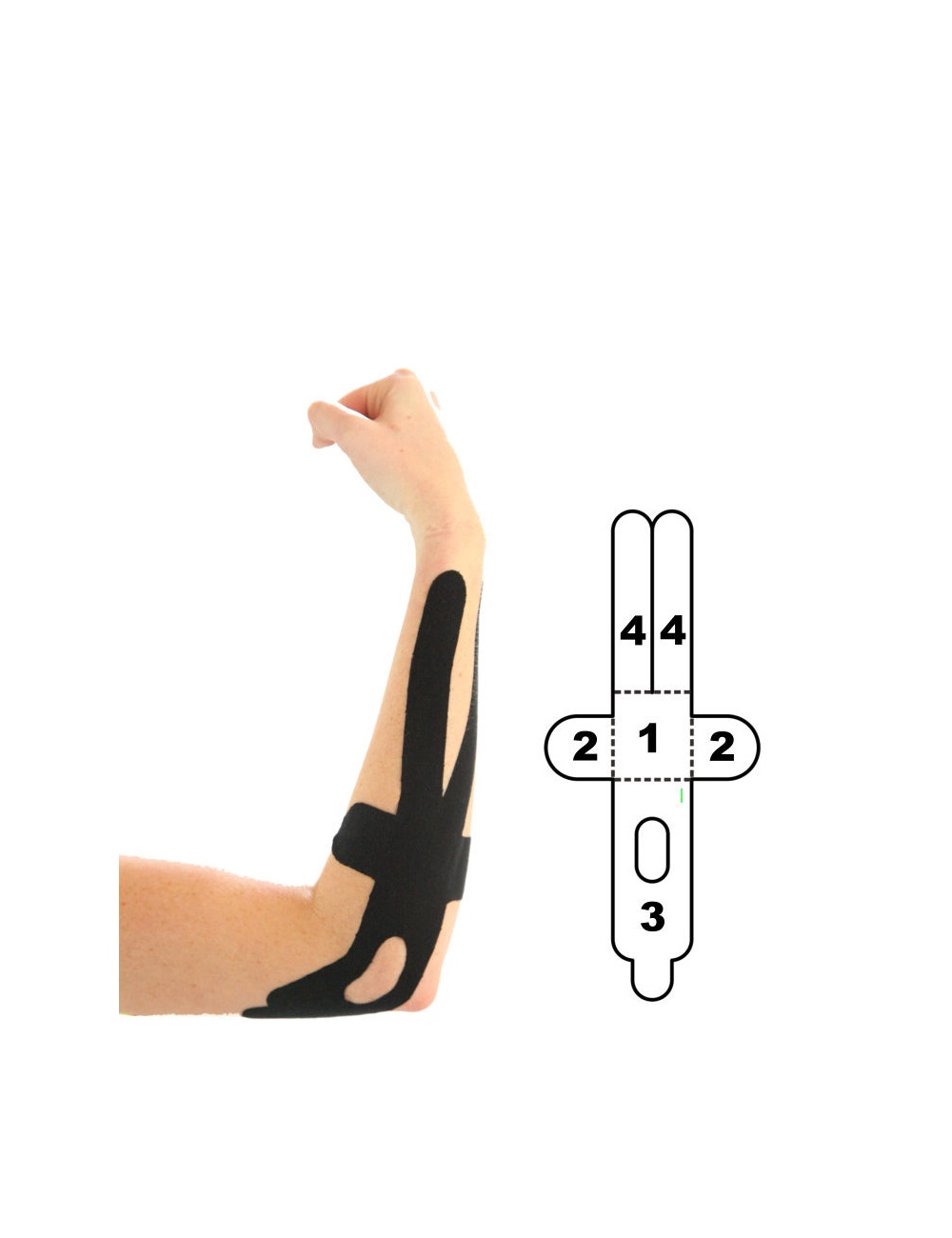 Pre-cut Kinesiology Tape WAS £6.48 NOW £2.99 Black/Blue/Beige For Elbow 