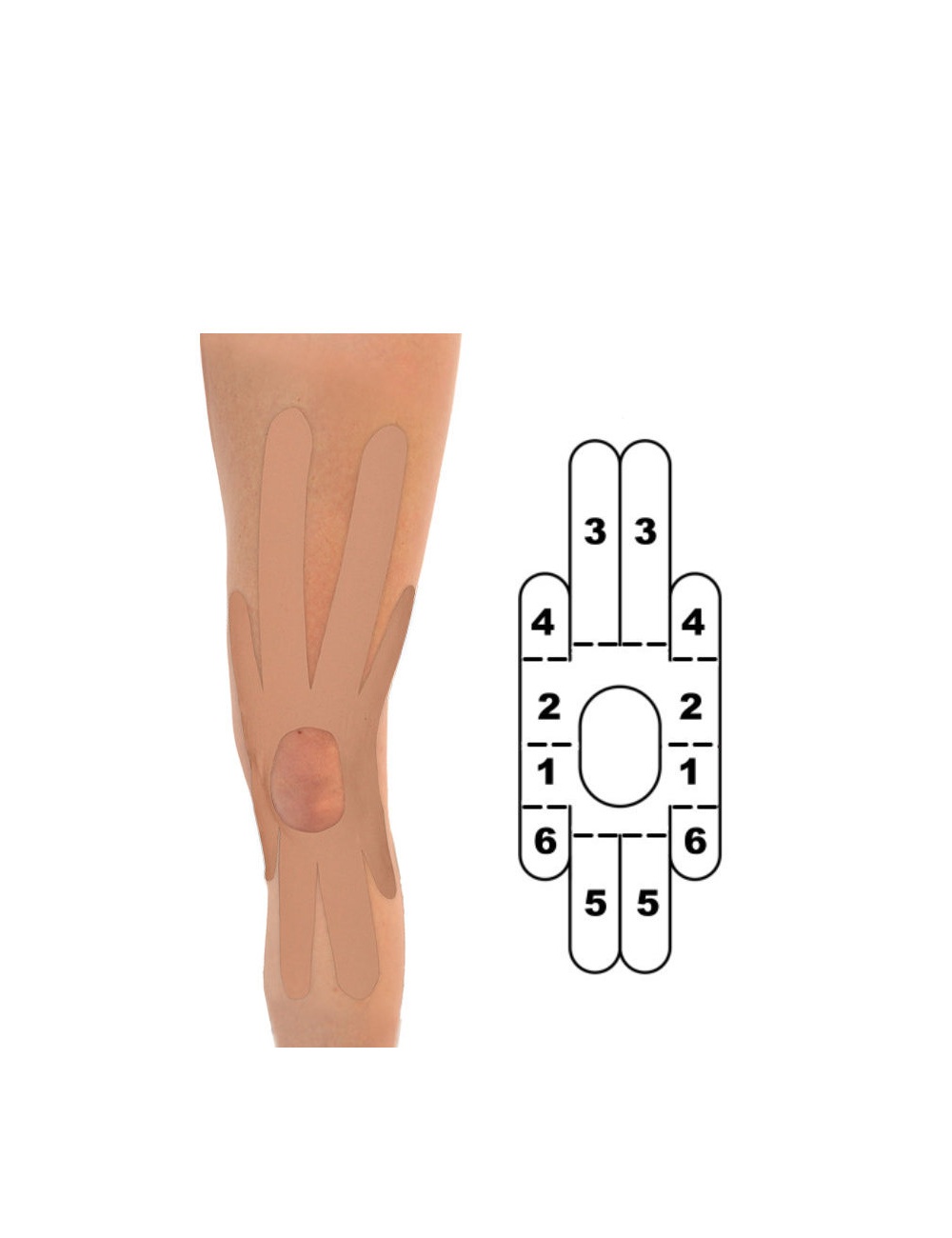 Kindmax Kinesiology Tape Knee Support - Beige