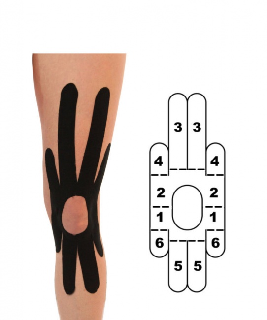 Pre-Cut Kinesiology Tape Knee Gripit 