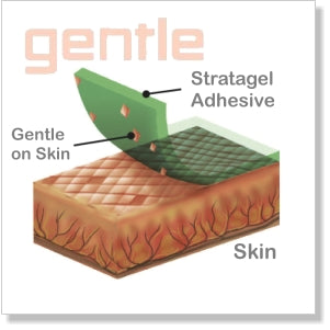 SpiderTech Gentle Stratagel Adhesive
