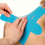 How to Apply Kinesiology Tape
