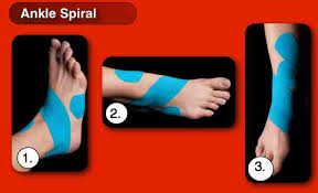 Kinesiology Taping for Ankle Stability