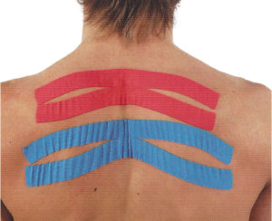 How does kinesiology tape work