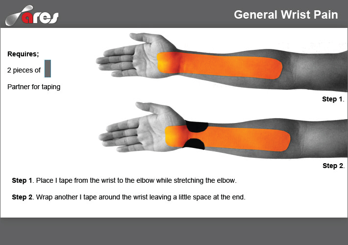 General-Wrist-Pain