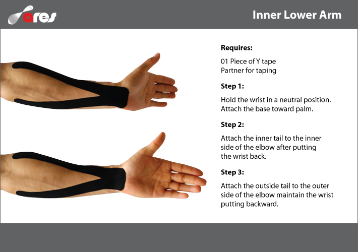Inner Lower Arm Pain