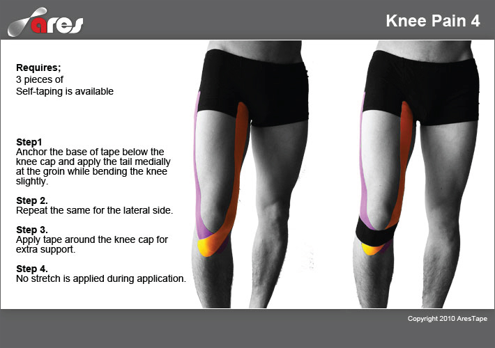 Knee-Pain-4