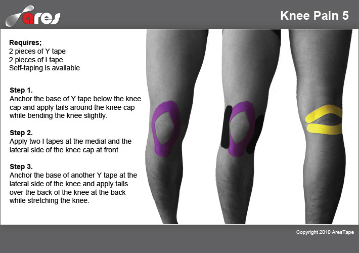 Knee-Pain-5
