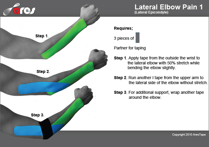 Lateral-Elbow-Pain-1