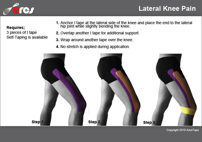 Lateral-Knee-Pain