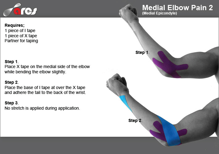 Medial-Elbow-Pain-2