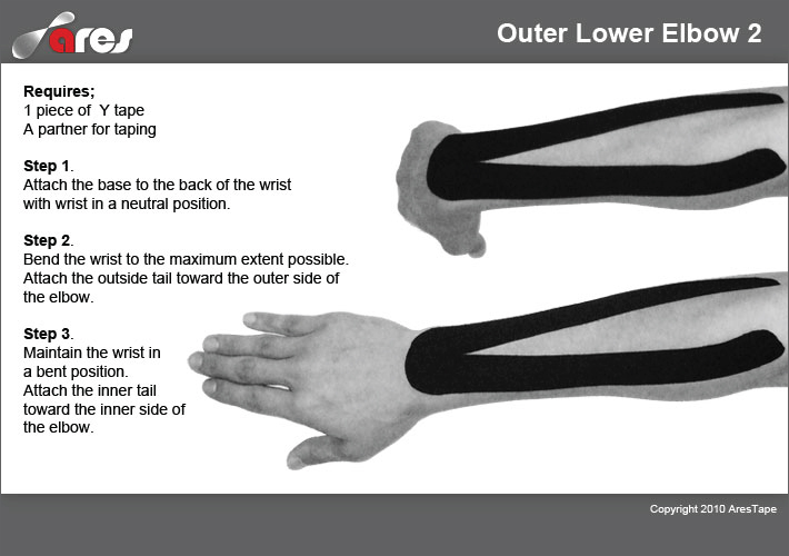 Outer-Lower-Elbow-2