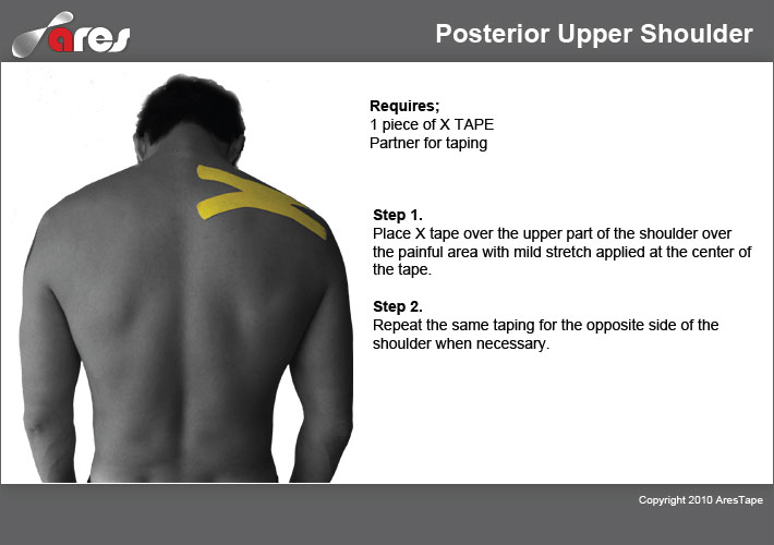 Posterior-Upper-Shoulder