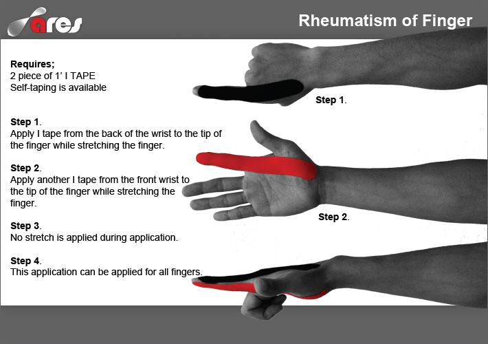 Rheumatism-of-Finger-treatment