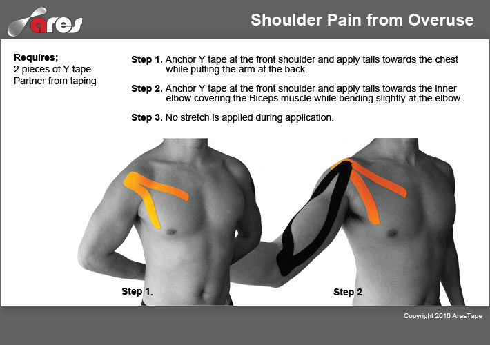 Shoulder-Pain-from-Overuse