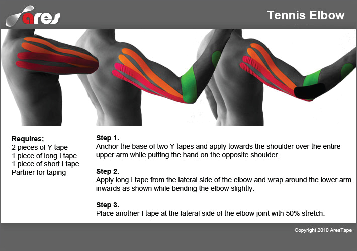 Tennis-Elbow-treatment