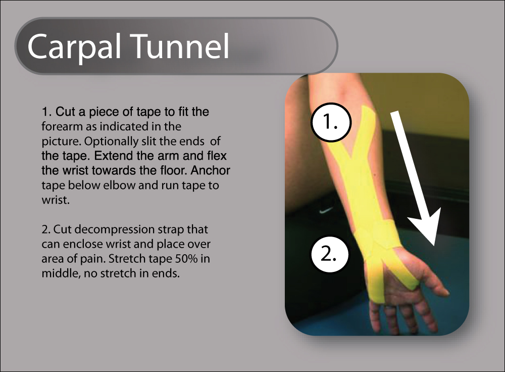 Carpal-Tunnel