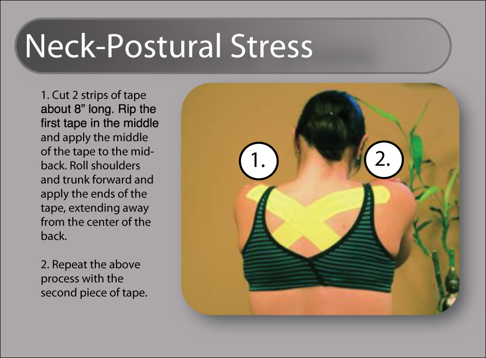 Neck-Postural-Stress